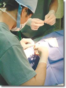 二重まぶた手術2