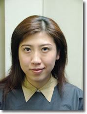 二重まぶた手術4